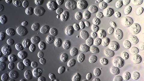 Yeast Saccharomyces Cerevisiae - DIC microscope 1000x
