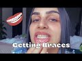 Getting Braces For The First Time Vlog [part 1]