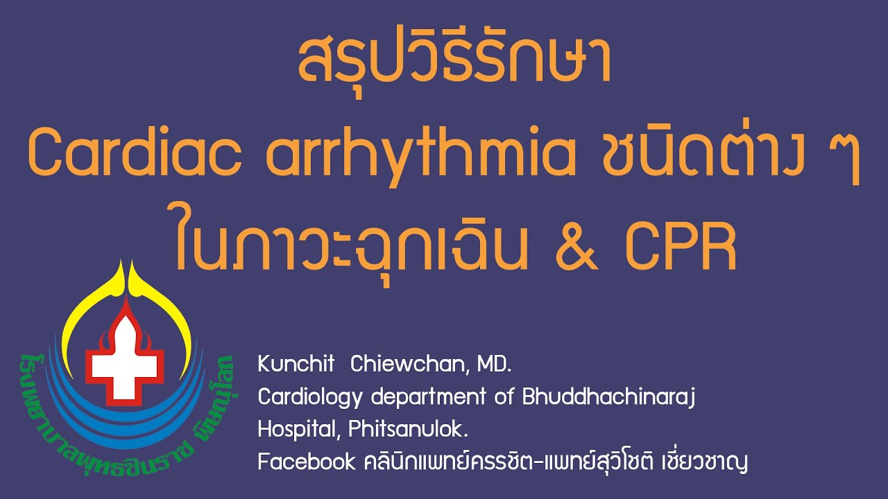 สรุปวิธีรักษา Cardiac arrhythmia ชนิดต่าง ๆ ในภาวะฉุกเฉิน & CPR