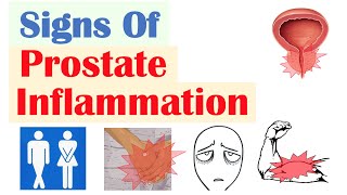 Prostate Inflammation Signs & Symptoms (& Why They Occur)