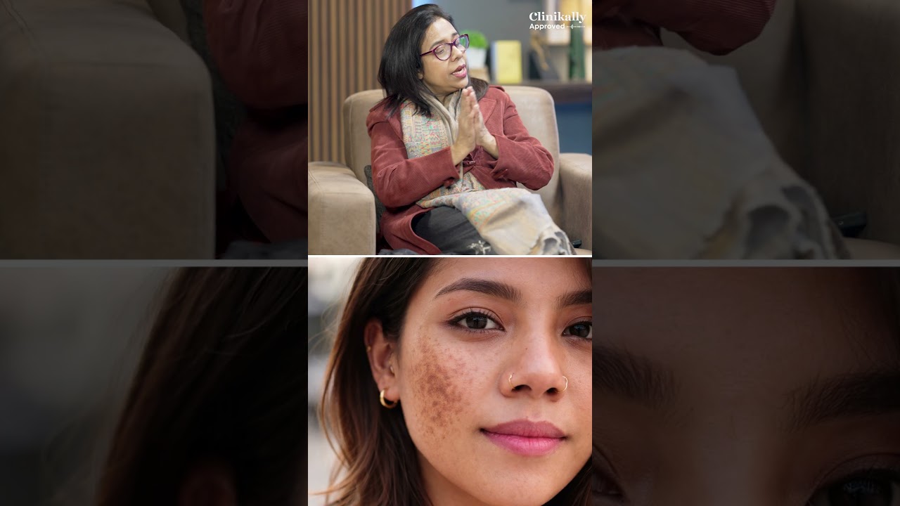 Is Dull Skin Same as Pigmentation? | Doctor Explains
