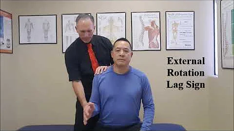 External Rotation Lag Sign
