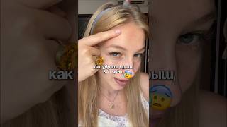 Забирай артикул WB WW337949 на сыворотку от прыщей арт озон 2438035334ПР