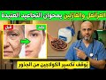 ضعي القرنفل مع الفازلين على تجاعيدك قبل النوم وستختفي الخطوط وتعود بشرتك أصغر بسنوات  نجومي