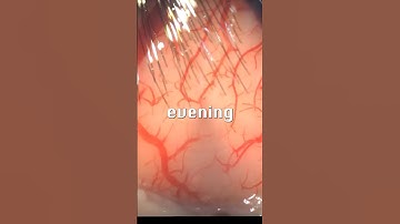 Elon Musk’s #neuralink says it has fda approval for human brain trials.