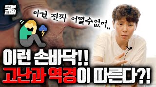 손바닥이 유난이 XX한 사람은 선천적으로 인생이 쓰다?! 이건 불가항력이야,, 후천적으로 무마해야해,,