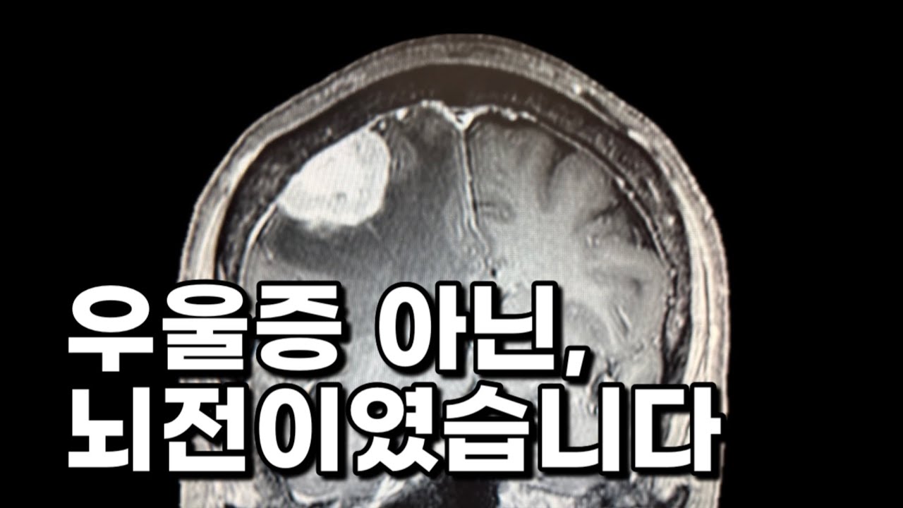 우울증이 아닌 뇌전이 였습니다 / 유방암 / 4기 암환자