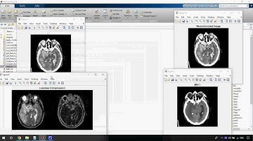A Fast Fractal Based Compression for MRI Images in Matlab