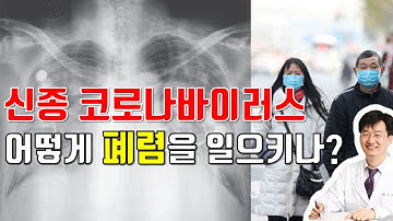 폐렴은 어떻게 진단하고 치료할까요? (신종 코로나바이러스)