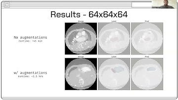CNN for CT Segmentation