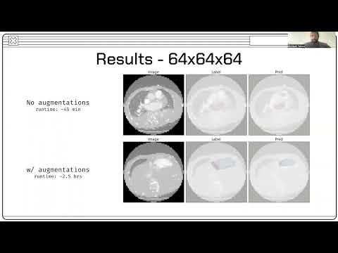 CNN for CT Segmentation