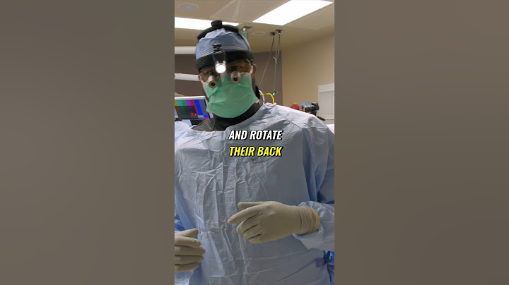 Can You Still Bend After a Spinal Fusion?