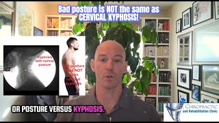Bad Posture Vs Kyphosis! They are not the same!