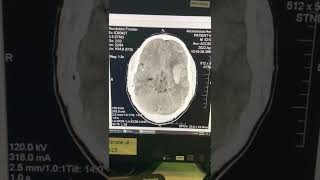 IMG 4411