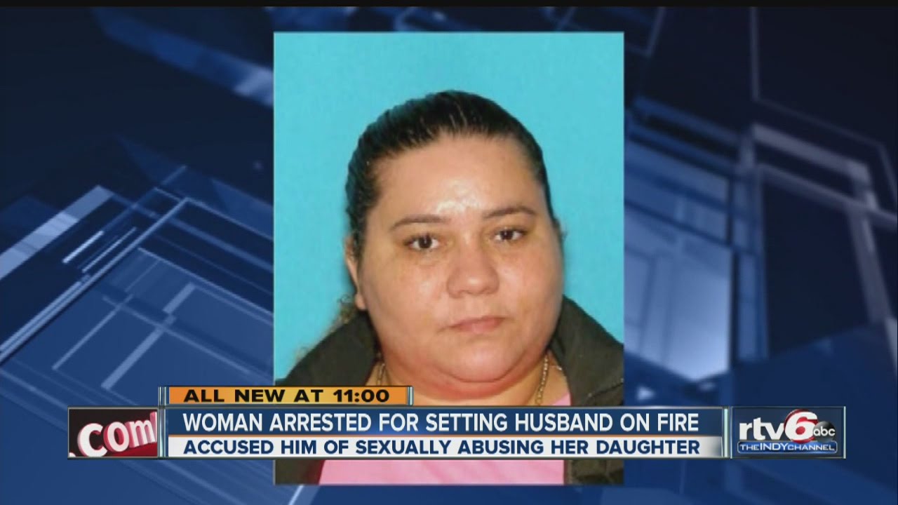 PD: Wife set husband on fire for allegedly molesting her 7-year-old ...