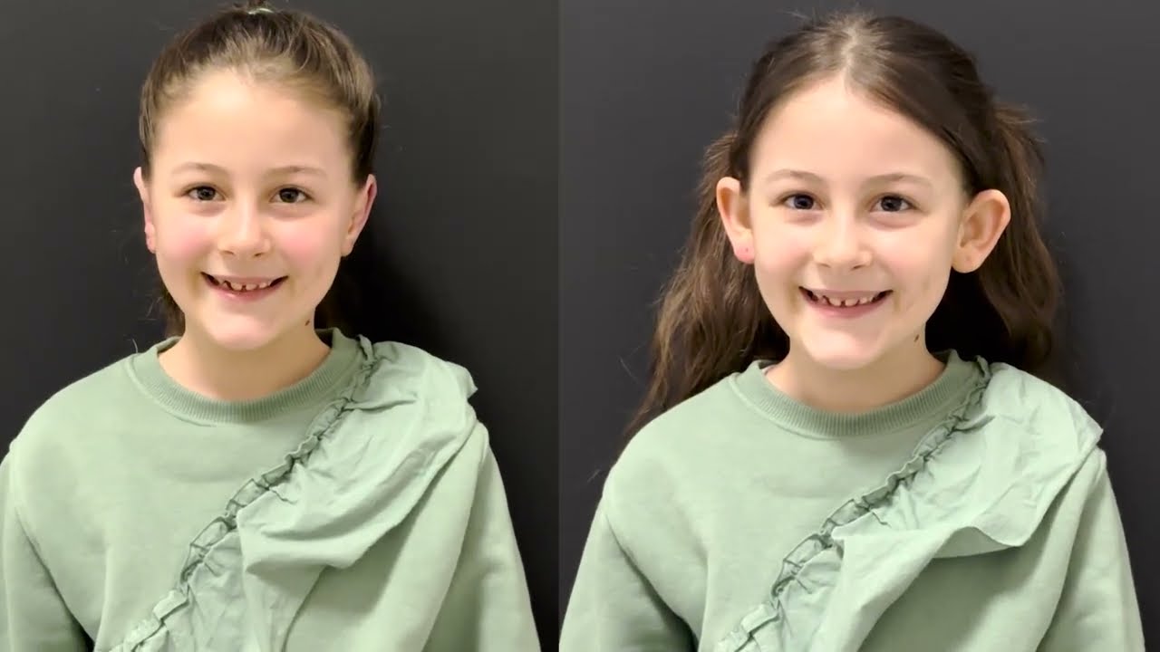 7 Yaşındaki İdil'in Kepçe Kulak Ameliyatı | 