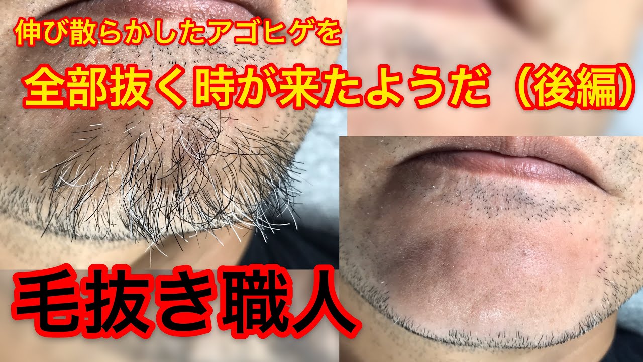 伸び散らかしたアゴヒゲを毛抜きで一気に全部抜いてみた 後編 19 10 23 Plucking Facial Hair Youtube 伸び散らかしたアゴヒゲを毛抜きで一気に全部抜いてみた 後編 19 10 23 Plucking Facial Hair Youtube