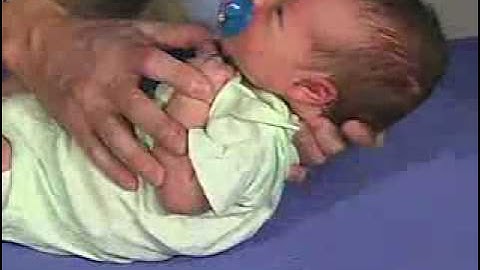 Moro Reflex