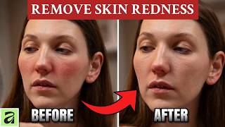 How to Remove Skin Redness in Affinity