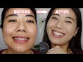 HOW TO COVER ACNE with the BareMinerals Matte Powder Foundation UPDATED 2021