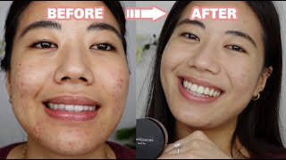 HOW TO COVER ACNE with the BareMinerals Matte Powder Foundation UPDATED 2021 screenshot 5