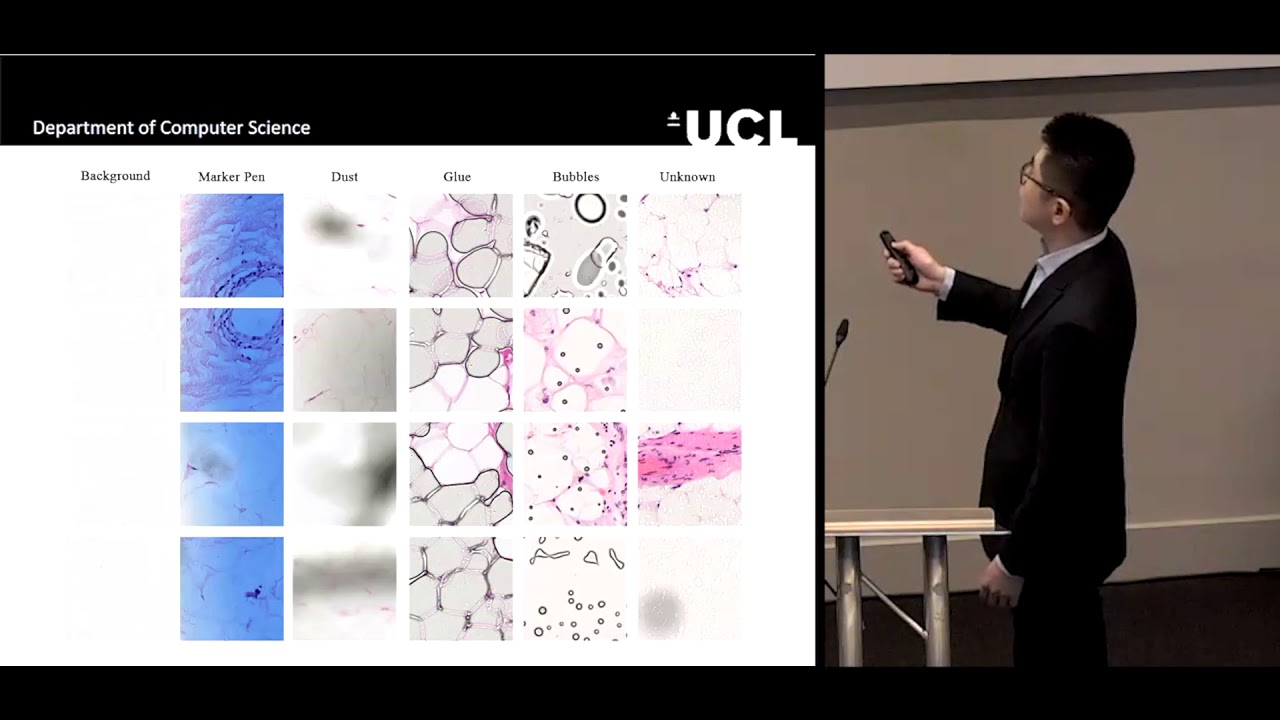 ECDP 2019 | An emerging role for machine learning in the classification of tumours of fat...