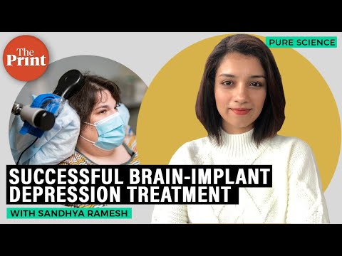 How clinical depression is being successfully treated through implant thumbnail