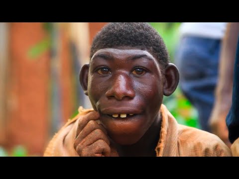 Vídeo: Krao: A História Da "garota Macaco" Cabeluda - Visão Alternativa