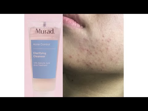 THIS PRODUCT MADE MY SKIN BREAKOUT MURAD ACNE CONTROL CLEANSER
