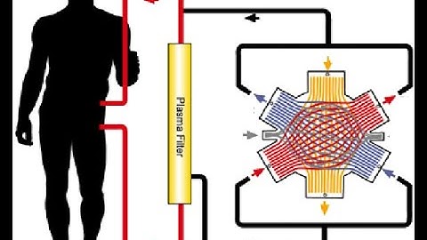 HRS (Hepatorenal Syndrome) Overview_Dr Pradeep Rangappa