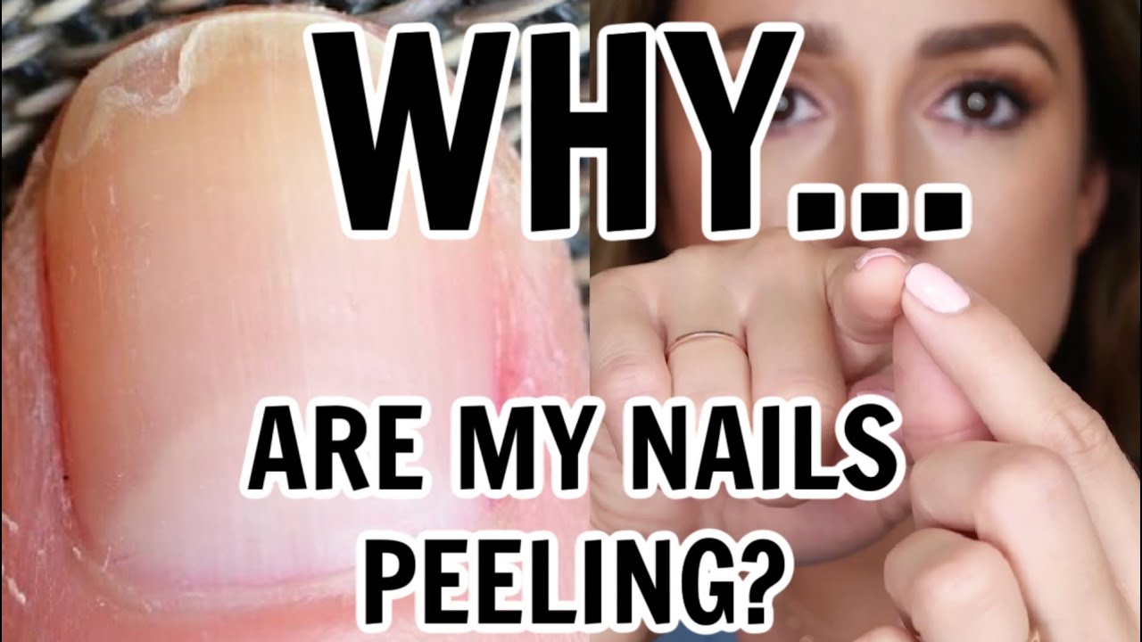 STOP The Peeling Of Your Nails - YouTube