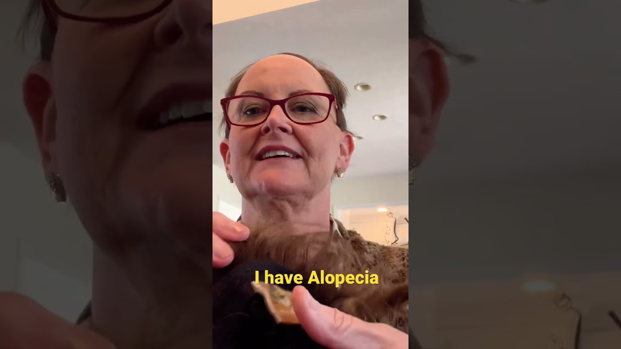 Have Alopecia and Have Wig Detangling Hack For Your Short Synthetic Styles