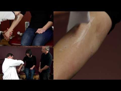 Elbow Rehab -