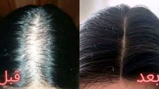 وصفة لتطويل الشعر بسرعة الصاروخ my Hair care routine  healthy hair