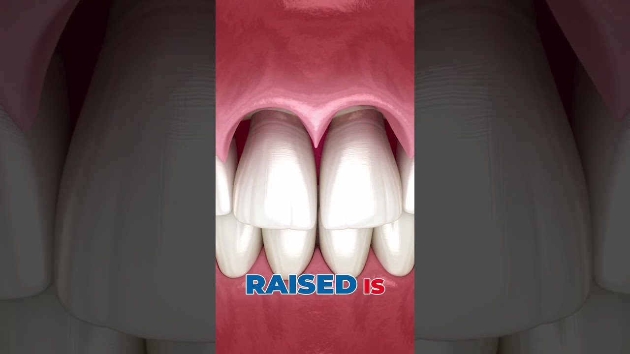 How Flap Surgery Saves Your Teeth (Indian Dentist Explains)