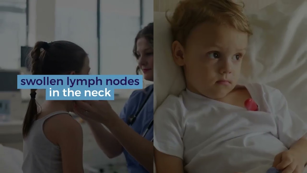 Kawasaki Disease explained in detail with images 