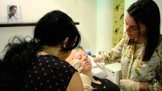 Juvederm Smile Lines at Tracey Bell