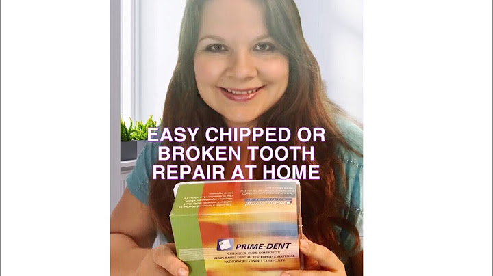 DIY CHIPPED TOOTH AT HOME - $24.00 WITH PRIME DENT