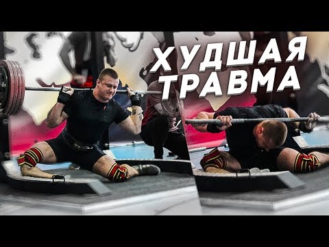 ТРАВМА, которая меня изменила / Что дальше