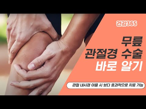 무릎 관절경 수술, 바로 알기 [TBC클리닉건강365]