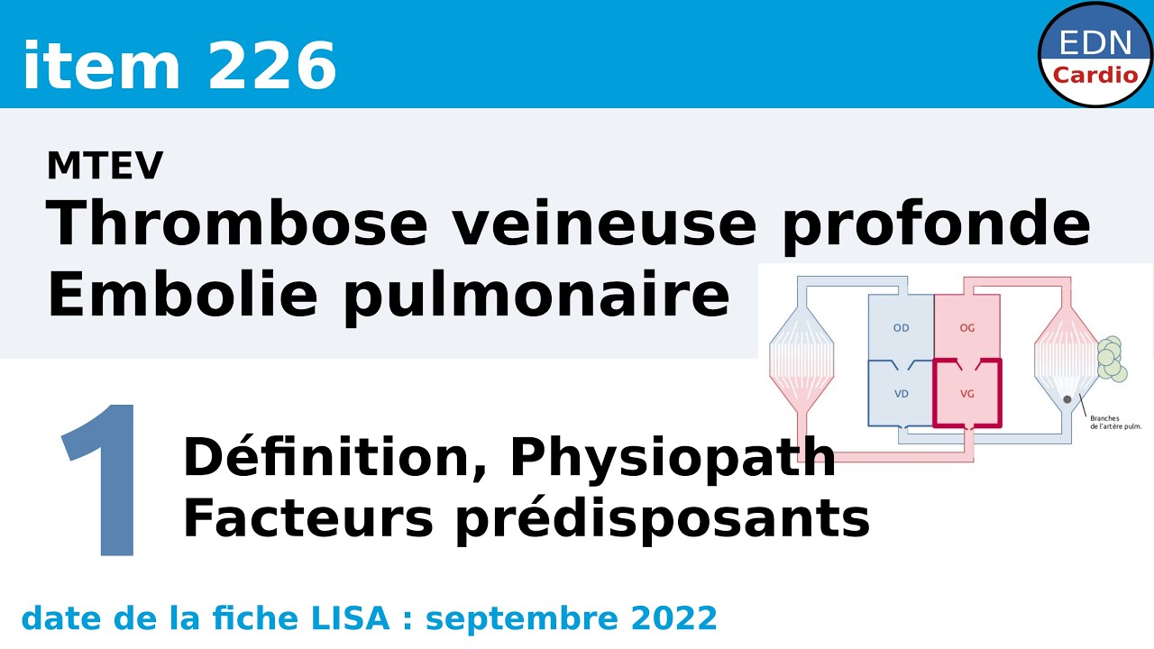226 MTEV (Thrombose veineuse profonde et embolie pulmonaire) Partie 1 Physiopathologie 226 MTEV (Thrombose veineuse profonde et embolie pulmonaire) Partie 1 Physiopathologie