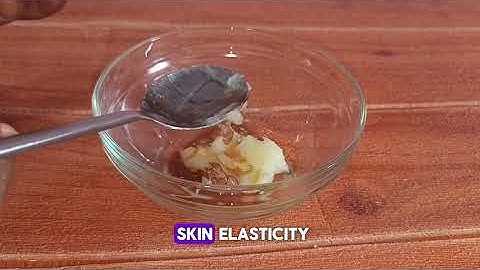 Remove STRETCH MARKS Fast with 4 NATURAL Ingredients! | Vaseline, Honey, Coconut Oil & Aloe Vera