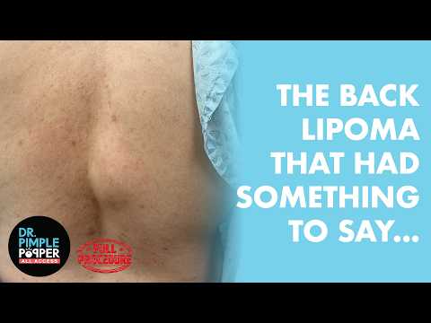 ALL ACCESS EXCLUSIVE | THE LIPOMA THAT HAD SOMETHING TO SAY