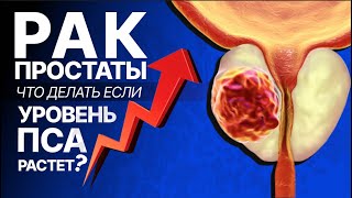 Рак простаты. Прогноз и факторы риска. Современные подходы к диагностике и лечению