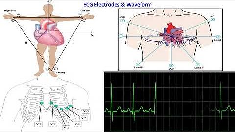ECG Recording system