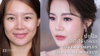 ปกปิดยังไงให้บางเบา l Cover Pimples with Light Makeup l By Krupao