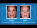 Pigmentation Problems Obagi Sheds Light on Dark Spots