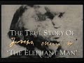 The Elephant man - QED - Documentary - The True Story Of Joseph Merrick