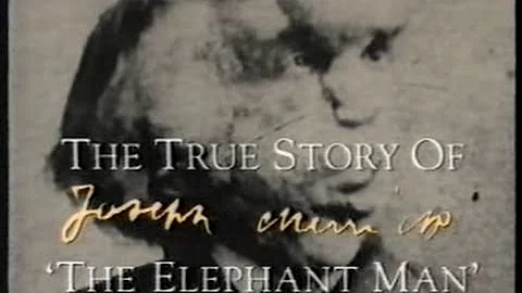 The Elephant man - QED - Documentary - The True St...