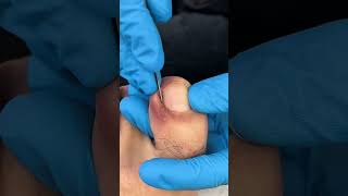 Satisfying nail cleaning process#nailcare #pedicure #satisfying #nailtech #oddlysatisfying #fyp